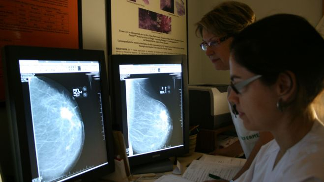 Dos enfermeras consultan una mamografía Dos enfermeras consultan una mamografía