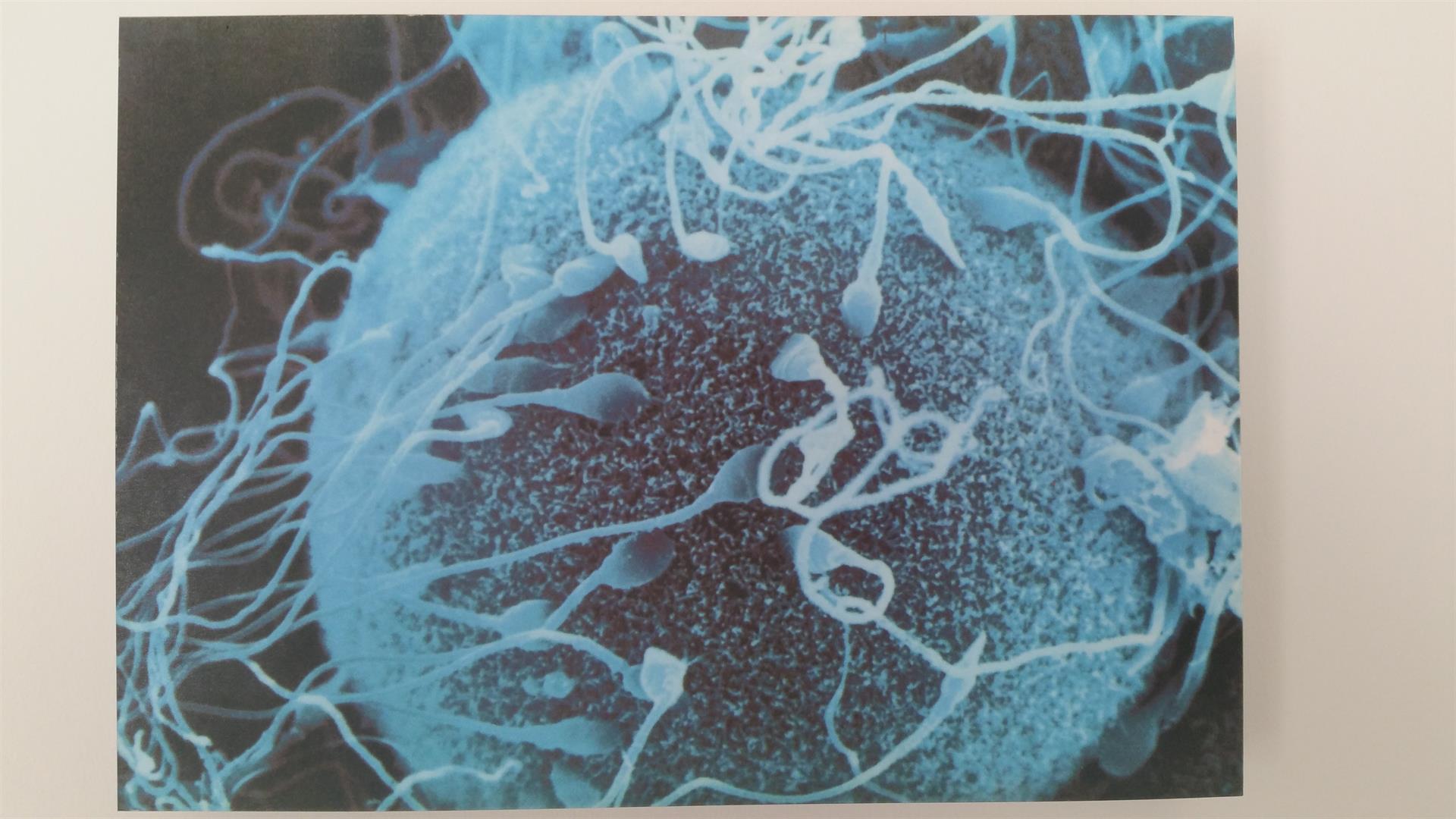 Espermatozoide en la superficie del óvulo