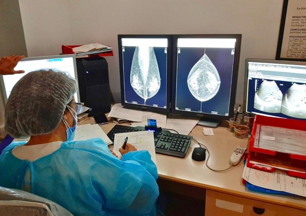 Cáncer de mama Cáncer de mama